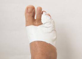 Image of a bandaged toe
