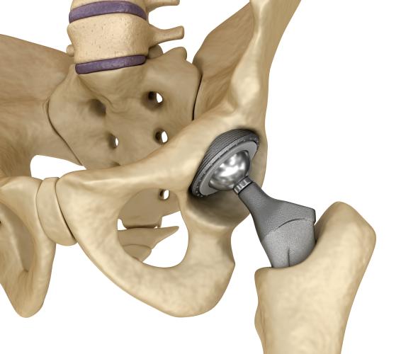 hip device 